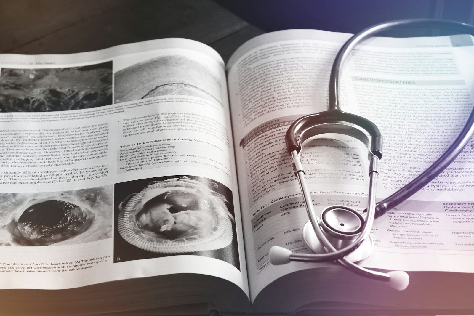 Estetoscópio sobre fundo claro.